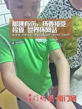 脚踝有伤,扬要接受检查_世界杯网站(图1) 世界杯网站